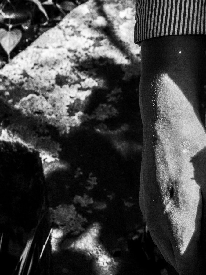 Getting Burned by David Macke Getting Burned by David Macke Vanity Teen 虚荣青年 Lifestyle & new faces magazine