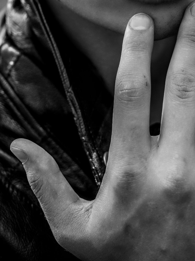 Getting Burned by David Macke Getting Burned by David Macke Vanity Teen 虚荣青年 Lifestyle & new faces magazine